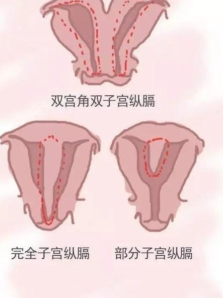 沈阳曙光医院试管婴儿费用多少？沈阳曙光医院能做试管婴儿吗？