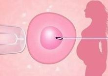 嘉兴哪里治不孕不育（嘉兴不孕不育医院哪个医院较好）