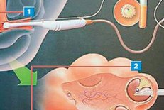 新的：泰国三代试管婴儿花费明细表分析！