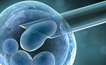 造成13号染色体重复的原因探析：父母年龄是否为关键因素？